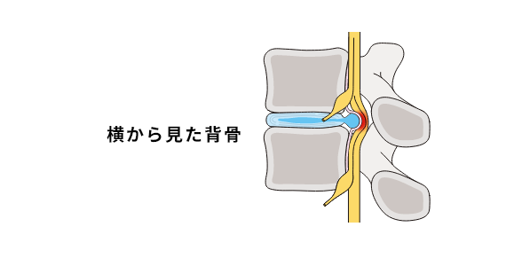 横から見た背骨